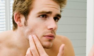 Chăm sóc da mặt nam bị thâm sau mụn